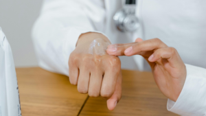 Understanding Eczema: Causes, Symptoms, and Modern Treatment Options