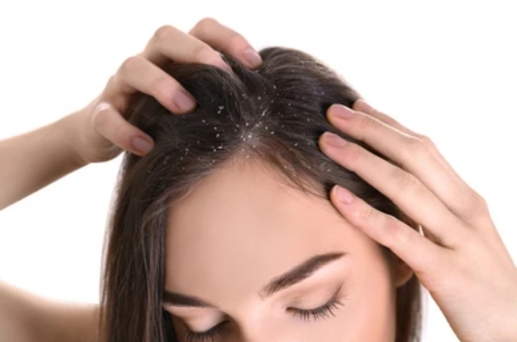 Dandruff and Hair Fall Treatment