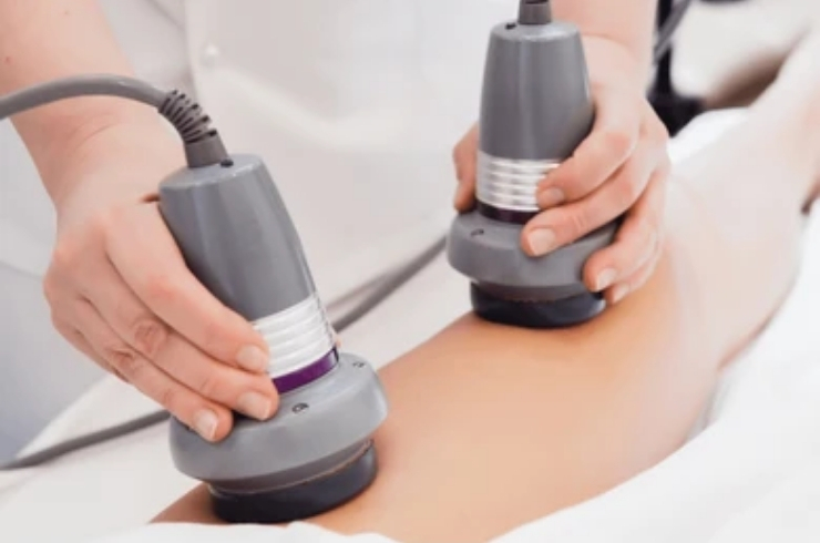 Radiofrequency Body Contouring-------14